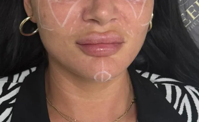 Joeelle Aesthetic Clinic
