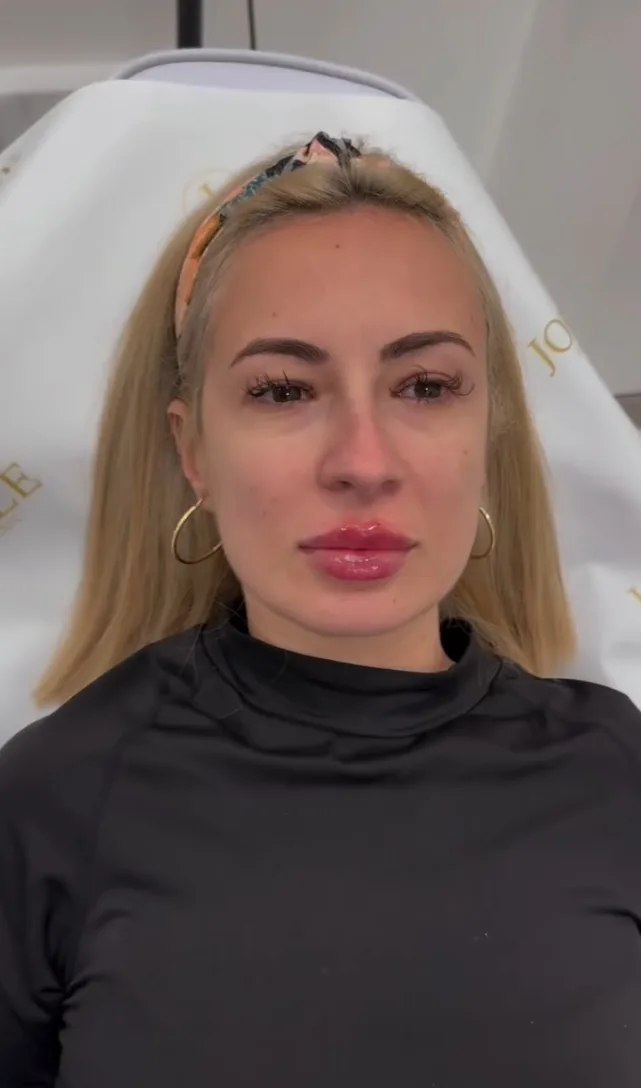 Pacientă JOEELLE