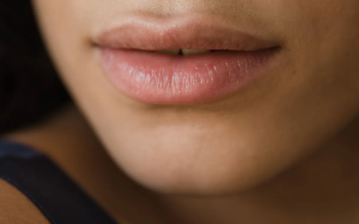 Augmentare buze (Russian Lips), JOEELLE
