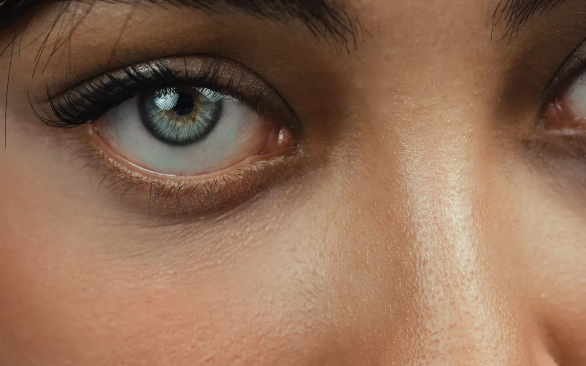 Blefaroplastie totală, JOEELLE