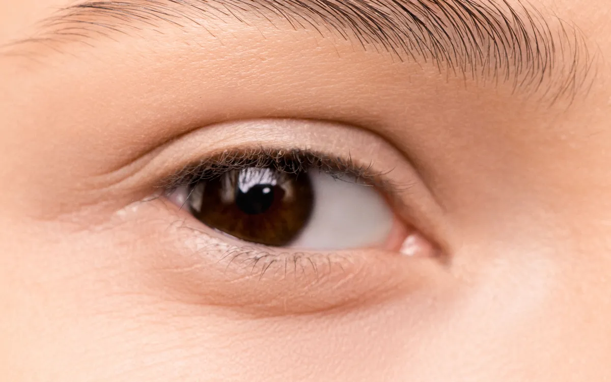 Blefaroplastie superioară, JOEELLE